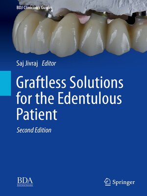 cover image of Graftless Solutions for the Edentulous Patient